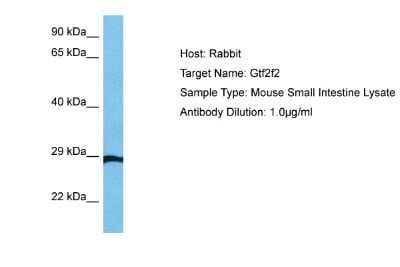 Western Blot: RAP30 Antibody [NBP3-17980]