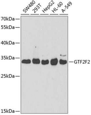 Western Blot: RAP30 AntibodyBSA Free [NBP3-17981]