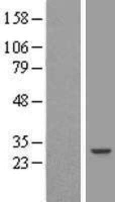 Western Blot: RAP30 Overexpression Lysate [NBP3-17995]