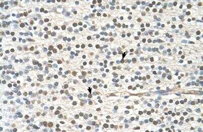 Immunohistochemistry-Paraffin: RAP6 Antibody [NBP1-53013]