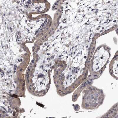 Immunohistochemistry-Paraffin: RAP6 Antibody [NBP1-85136]