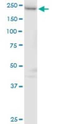 Western Blot: RAP6 Antibody [H00026130-B01P]