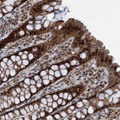 Immunohistochemistry: RAP74 Antibody [NBP3-17974]