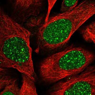 Immunocytochemistry/ Immunofluorescence: RAP80 Antibody [NBP1-87156]
