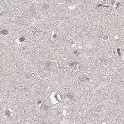 Immunohistochemistry-Paraffin: RAP80 Antibody [NBP1-87157]