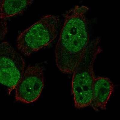 Immunocytochemistry/ Immunofluorescence: RAPGEF5 Antibody [NBP2-57362]