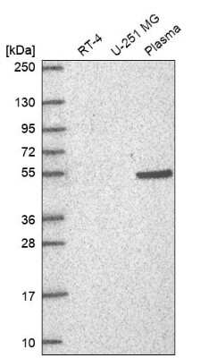 Western Blot: RAPGEF5 Antibody [NBP2-57362]