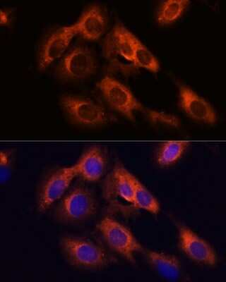 Immunocytochemistry/ Immunofluorescence: RAPH1 Antibody - Azide and BSA Free [NBP2-93675]
