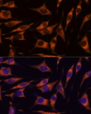 Immunocytochemistry/ Immunofluorescence: RAPH1 Antibody - Azide and BSA Free [NBP2-93675]