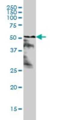 Western Blot: RAR alpha/NR1B1 Antibody (1C10) [H00005914-M02]