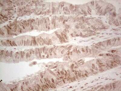 Immunohistochemistry: RAR alpha/NR1B1 Antibody (OTI2C3) [NBP2-45516]