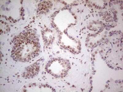 Immunohistochemistry: RAR alpha/NR1B1 Antibody (OTI2C3) [NBP2-45516]