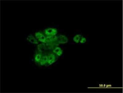 Immunocytochemistry/ Immunofluorescence: RAR alpha/NR1B1 Antibody (2C9-1F8) [H00005914-M01]