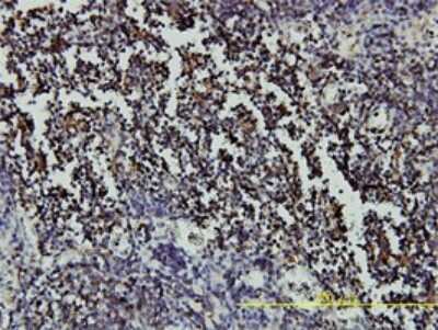 Immunohistochemistry-Paraffin: RAR alpha/NR1B1 Antibody (2C9-1F8) [H00005914-M01]