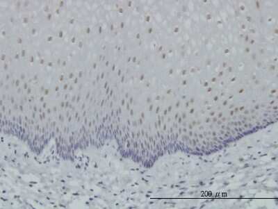 Immunohistochemistry-Paraffin: RAR alpha/NR1B1 Antibody (2D2) [H00005914-M03]