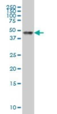 Western Blot: RAR alpha/NR1B1 Antibody (2D2) [H00005914-M03]