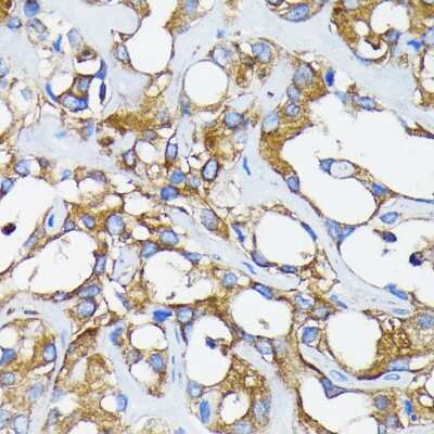 Immunohistochemistry-Paraffin: RAR alpha/NR1B1 Antibody (9C7R10) [NBP3-15770]