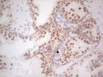 Immunohistochemistry: RAR alpha/NR1B1 Antibody (OTI2C3) - Azide and BSA Free [NBP2-73802]