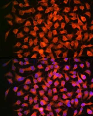 Immunocytochemistry/ Immunofluorescence: RAR beta/NR1B2 Antibody (6D5V4) [NBP3-16428]