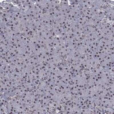 Immunohistochemistry-Paraffin: RAR beta/NR1B2 Antibody [NBP1-81776]