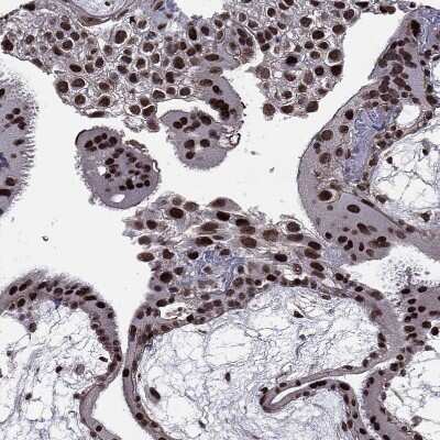 Immunohistochemistry-Paraffin: RAR beta/NR1B2 Antibody [NBP1-81776]