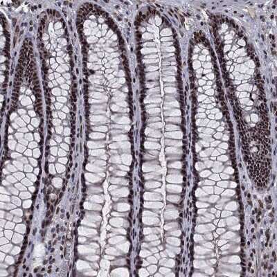 Immunohistochemistry-Paraffin: RAR beta/NR1B2 Antibody [NBP1-81776]