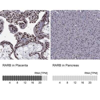 Immunohistochemistry-Paraffin: RAR beta/NR1B2 Antibody [NBP1-81776]