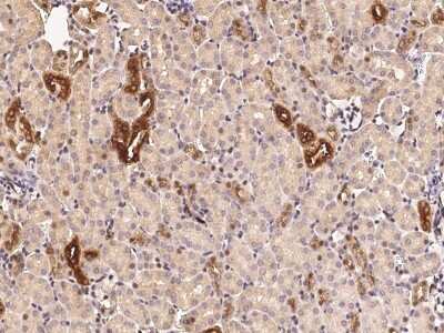 Immunohistochemistry-Paraffin: RAR beta/NR1B2 Antibody [NBP2-98903]