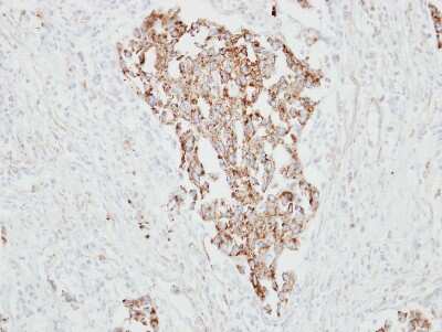 Immunohistochemistry-Paraffin: RARRES1 Antibody [NBP2-20079]