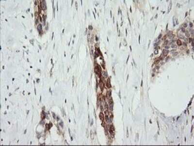Immunohistochemistry: RARRES1 Antibody (OTI1D2) - Azide and BSA Free [NBP2-73803]