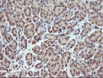 Immunohistochemistry: RARRES1 Antibody (OTI1D2) - Azide and BSA Free [NBP2-73803]