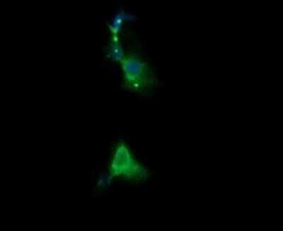 Immunocytochemistry/ Immunofluorescence: RARRES1 Antibody (OTI1D2) [NBP2-45517]