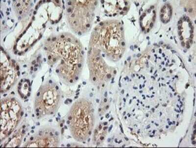 Immunohistochemistry: RARRES1 Antibody (OTI1D2) [NBP2-45517]