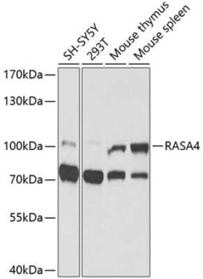 Western Blot: RASA4 AntibodyBSA Free [NBP2-93505]