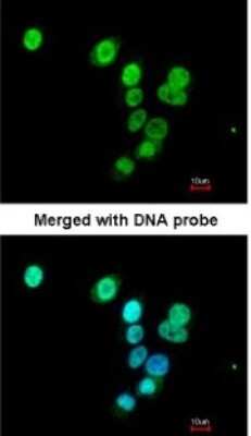 Immunocytochemistry/ Immunofluorescence: RASAL1 Antibody [NBP1-32776]