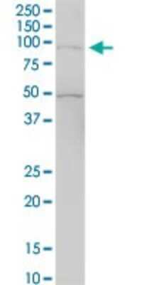 Western Blot: RASAL1 Antibody [H00008437-B01P]