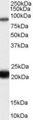 Western Blot: RASAL1 Antibody [NB100-55388]