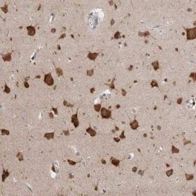 Immunohistochemistry-Paraffin: RASAL2 Antibody [NBP1-82578]