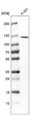 Western Blot: RASAL2 Antibody [NBP1-82578]