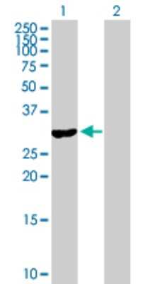 Western Blot: RASD2 Antibody [H00023551-B01P]