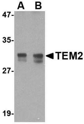 Western Blot: RASD2 AntibodyBSA Free [NBP1-77313]