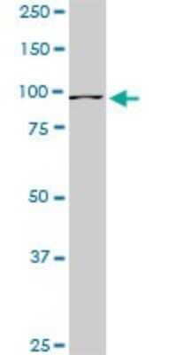 Western Blot: RASEF Antibody (1E3) [H00158158-M02]