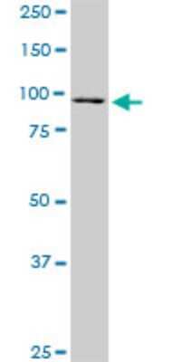 Western Blot: RASEF Antibody (1E3) [H00158158-M02]