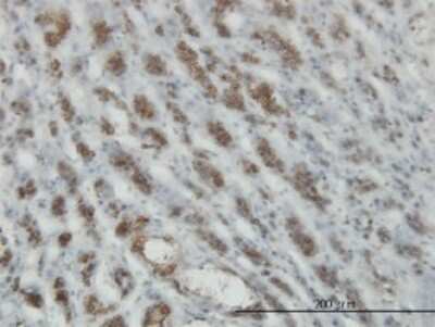 Immunohistochemistry-Paraffin: RASEF Antibody (2D5) [H00158158-M01]