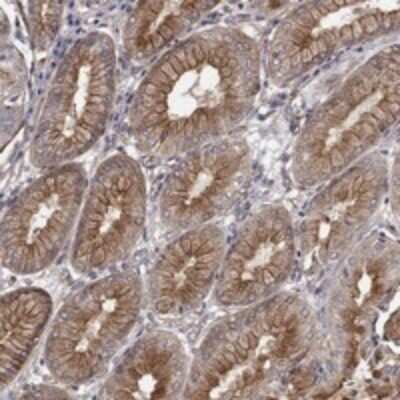 Immunohistochemistry-Paraffin: RASEF Antibody [NBP3-17920]