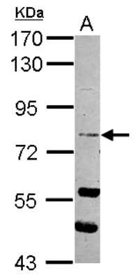 Western Blot: RASEF Antibody [NBP2-20083]