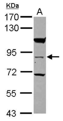 Western Blot: RASEF Antibody [NBP2-20084]