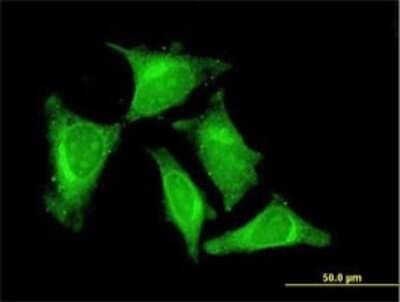 Immunocytochemistry/ Immunofluorescence: RASGEF1C Antibody (3H8) [H00255426-M01]