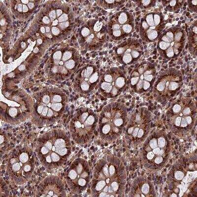 Immunohistochemistry-Paraffin: RASGRF1 Antibody [NBP1-85727]