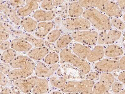 Immunohistochemistry: RASGRF1 Antibody [NBP3-06655]